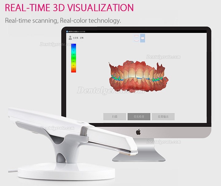 Runyes 3DS Dental 3D Digitaler Intraoralscanner Pulverloses Echtfarbscannen